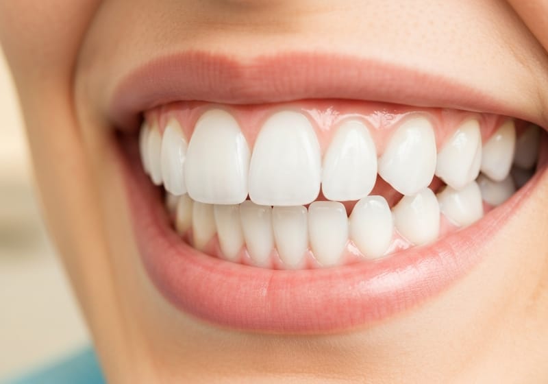 Sonrisa sana y limpia tras tratamiento profesional de higiene dental